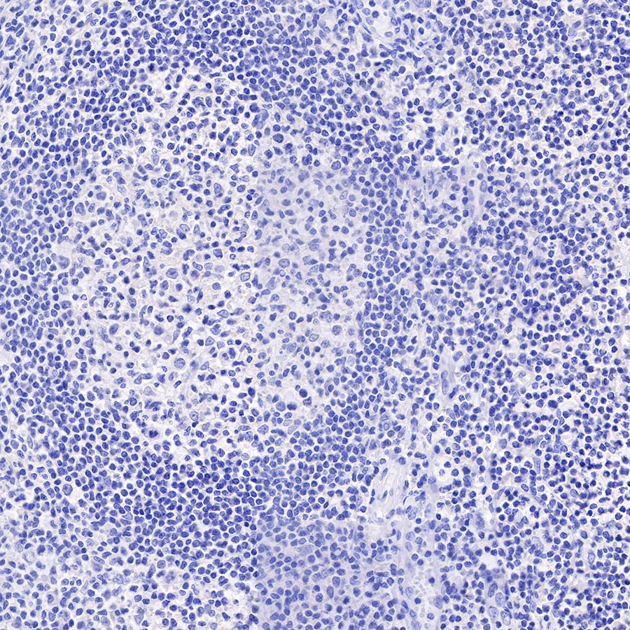 Rabbit anti-Cadherin 17 Recombinant Monoclonal Antibody(R151)