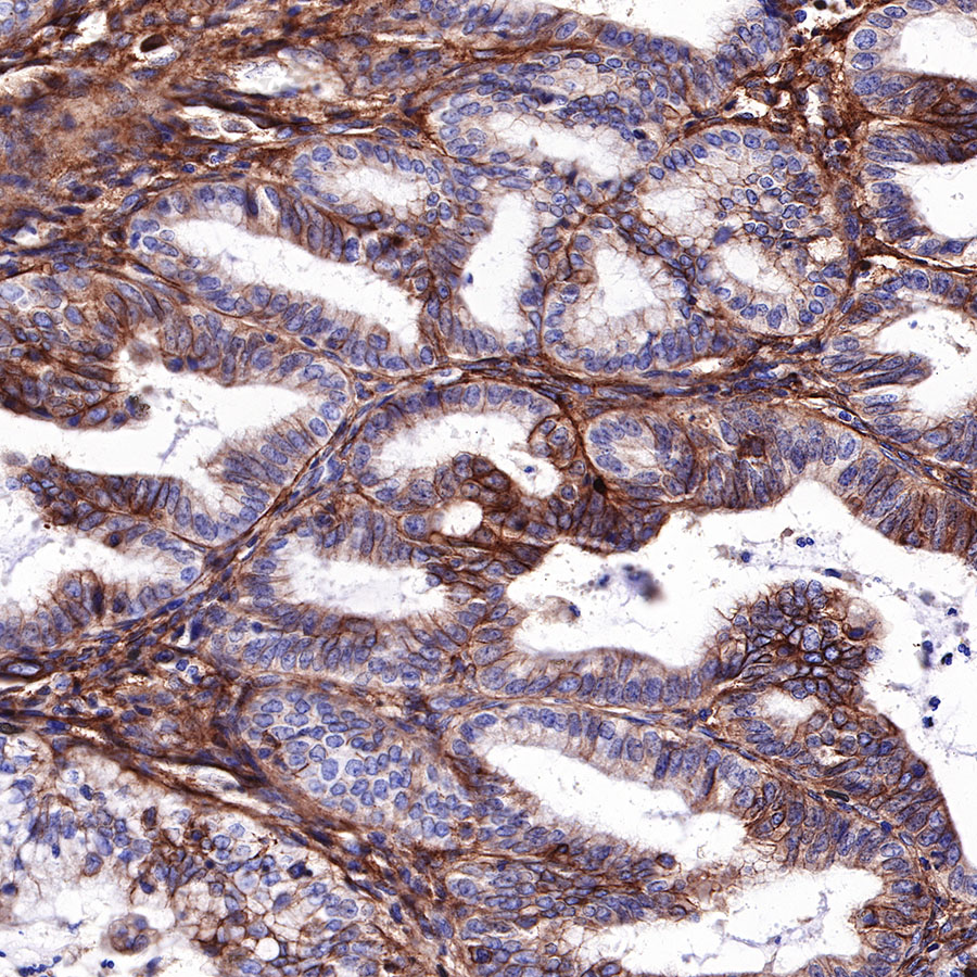 Rabbit anti-CD276 Recombinant Monoclonal Antibody(R158)