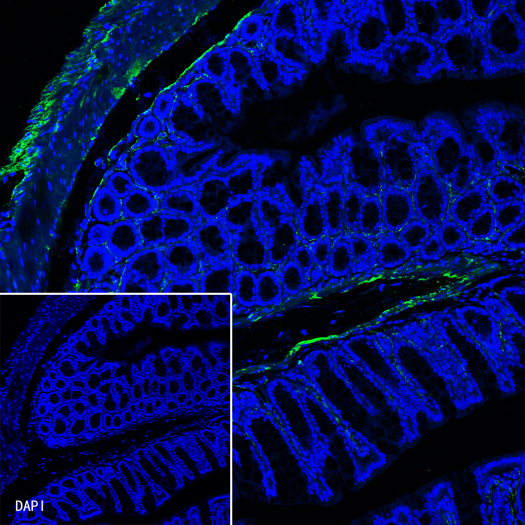 Rabbit anti-Myosin-11 Recombinant Monoclonal Antibody(188-112)