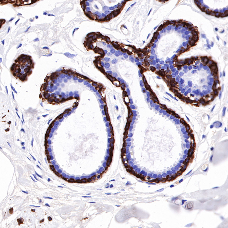 Rabbit anti-Myosin-11 Recombinant Monoclonal Antibody(188-112)