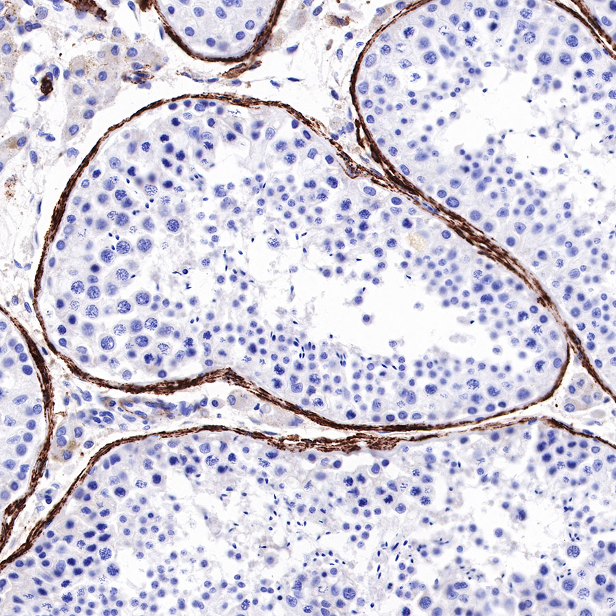 Rabbit anti-Myosin-11 Recombinant Monoclonal Antibody(188-112)