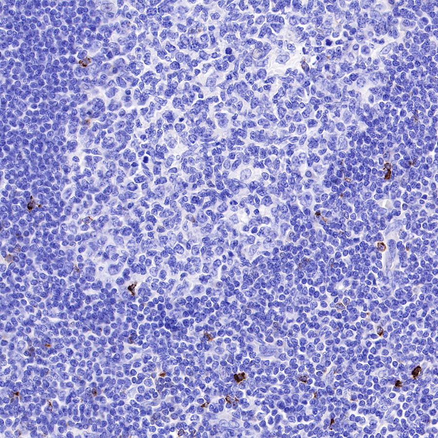 Rabbit anti-LAG3 Recombinant Monoclonal Antibody(R159)