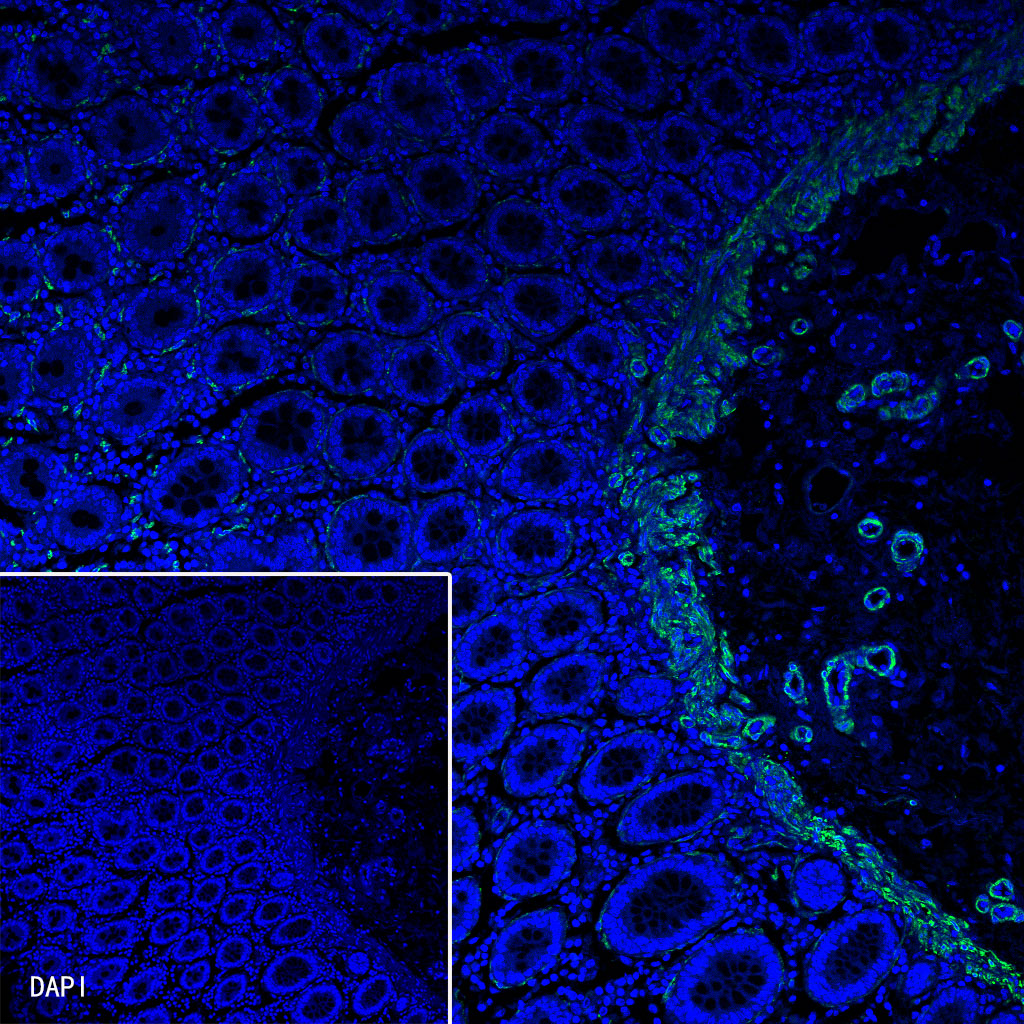 Rabbit anti-Myosin-11 Recombinant Monoclonal Antibody(188-112)