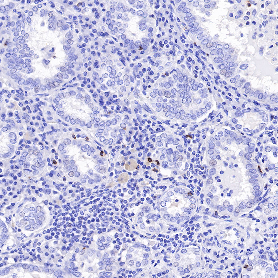 Rabbit anti-LAG3 Recombinant Monoclonal Antibody(R159)