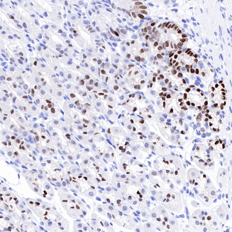 Rabbit anti-SOX9 Recombinant Monoclonal Antibody(019-29)