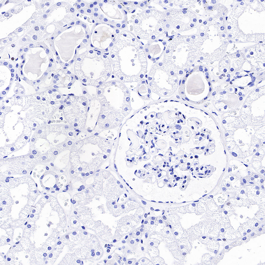 Rabbit anti-Androgen Receptor Recombinant Monoclonal Antibody(R157)