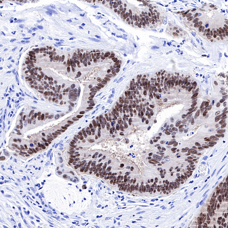 Rabbit anti-SOX9 Recombinant Monoclonal Antibody(019-29)