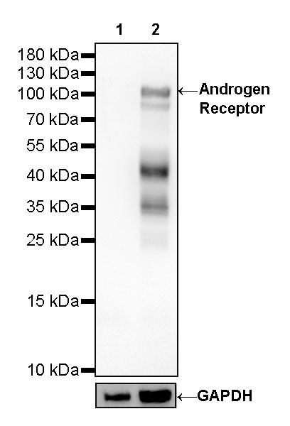 Rabbit anti-Androgen Receptor Recombinant Monoclonal Antibody(R157)