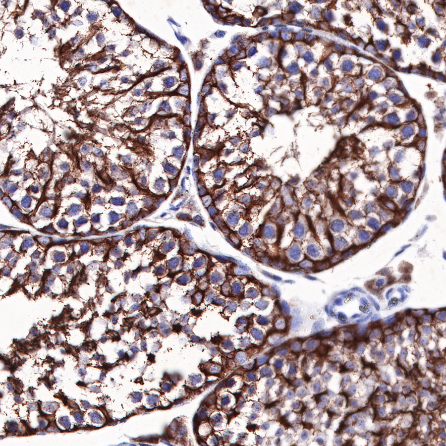 Rabbit anti-β III Tubulin Recombinant Monoclonal Antibody(251-28)