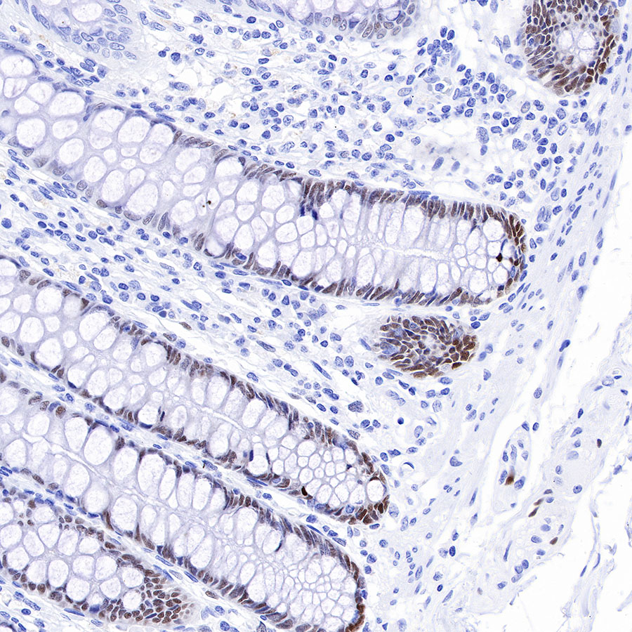 Rabbit anti-SOX9 Recombinant Monoclonal Antibody(019-29)