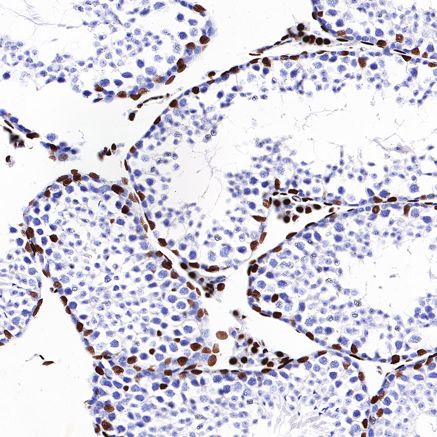 Rabbit anti-Androgen Receptor Recombinant Monoclonal Antibody(R157)