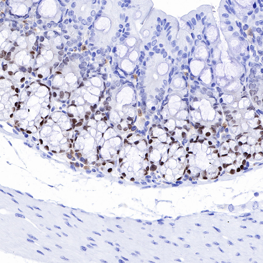 Rabbit anti-SOX9 Recombinant Monoclonal Antibody(019-29)