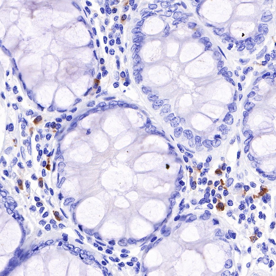 Rabbit anti-λ Light Chain Recombinant Monoclonal Antibody(326-22)