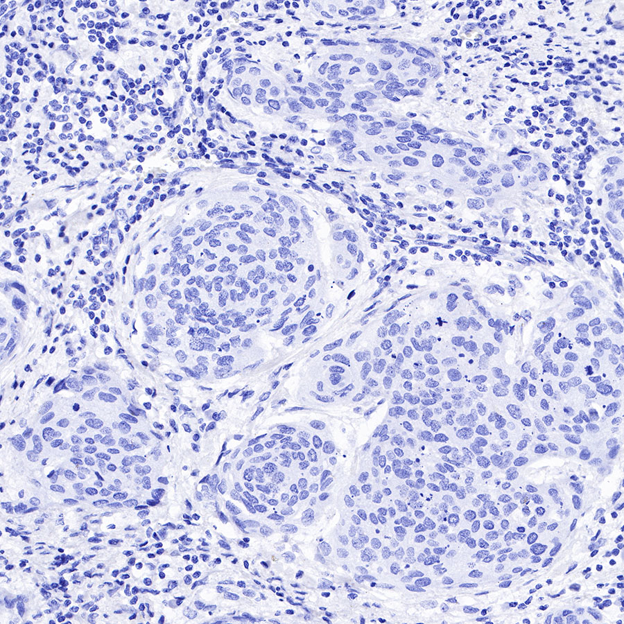 Rabbit anti-Androgen Receptor Recombinant Monoclonal Antibody(R157)