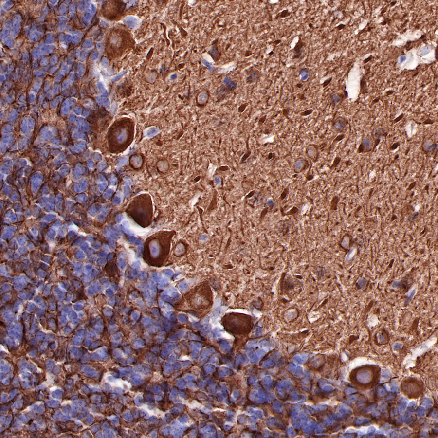 Rabbit anti-β III Tubulin Recombinant Monoclonal Antibody(251-28)