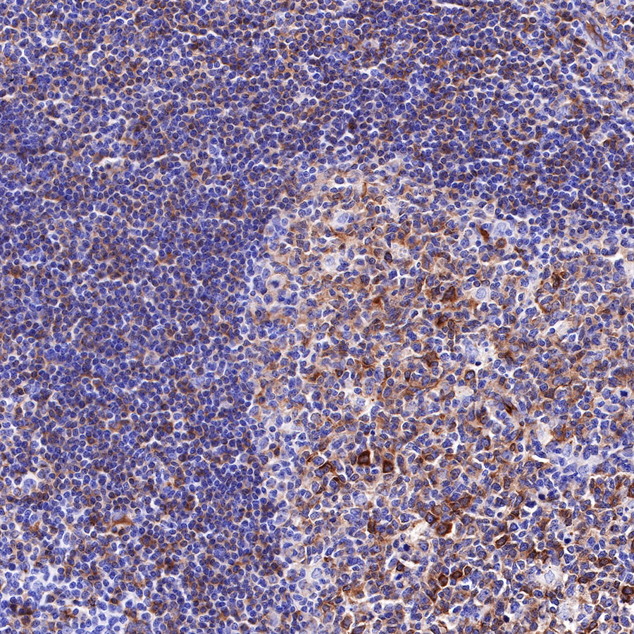 Rabbit anti-β III Tubulin Recombinant Monoclonal Antibody(251-28)