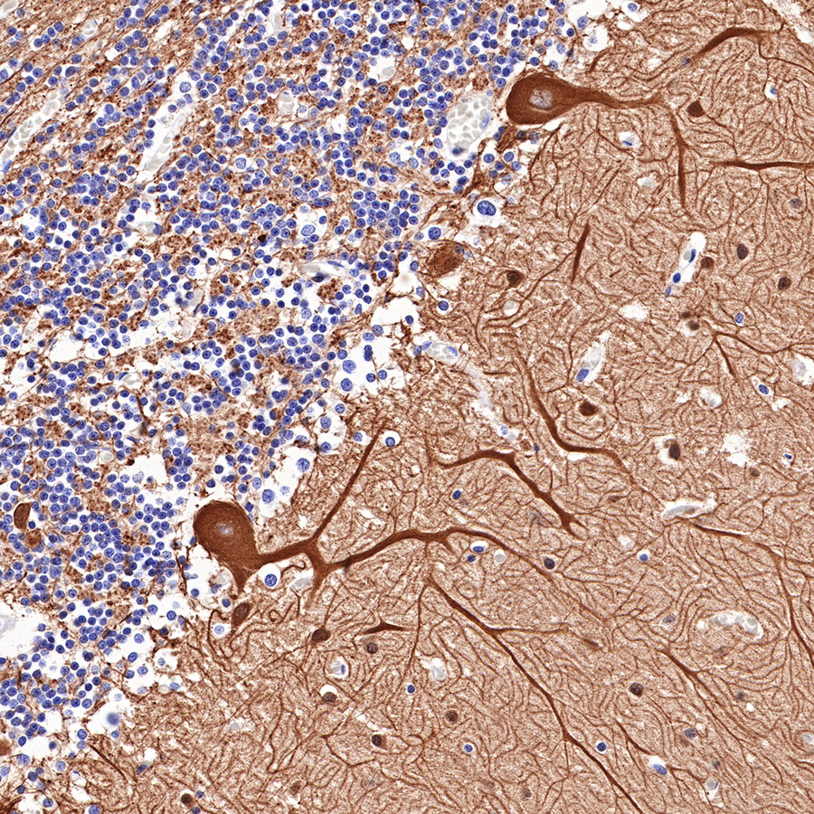 Rabbit anti-β III Tubulin Recombinant Monoclonal Antibody(251-28)