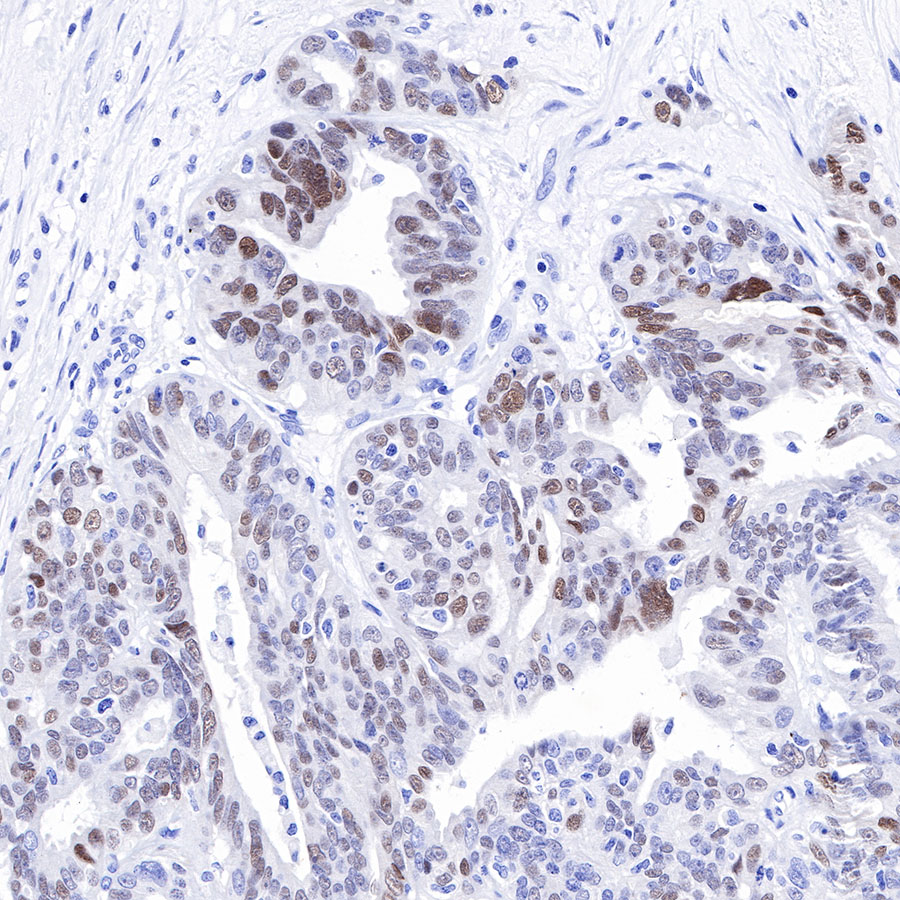 Rabbit anti-SOX9 Recombinant Monoclonal Antibody(019-29)