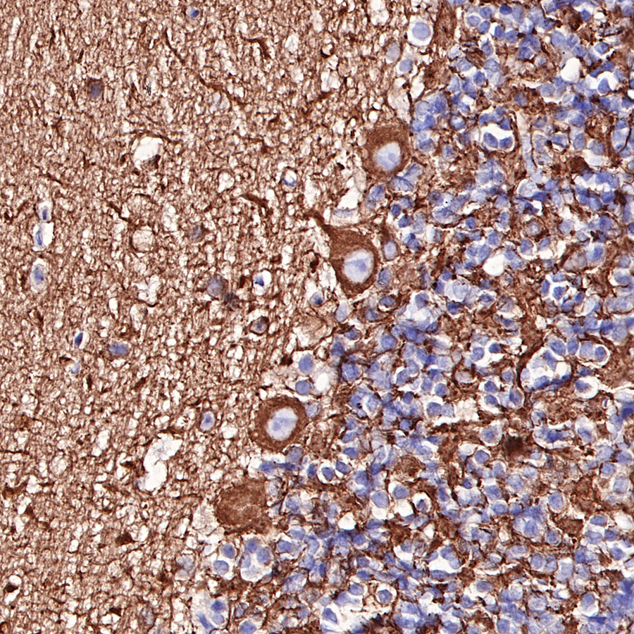 Rabbit anti-β III Tubulin Recombinant Monoclonal Antibody(251-28)
