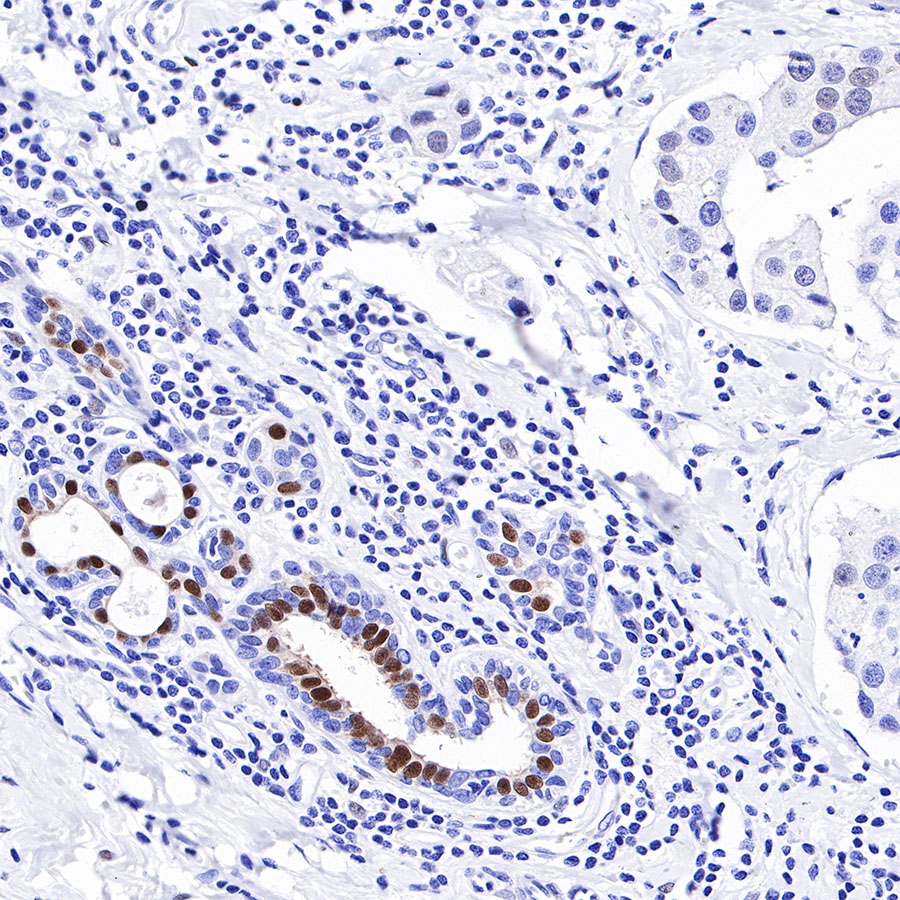 Rabbit anti-Androgen Receptor Recombinant Monoclonal Antibody(R157)