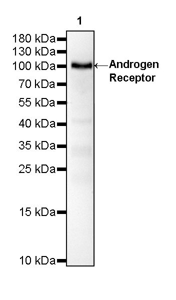 Rabbit anti-Androgen Receptor Recombinant Monoclonal Antibody(R157)