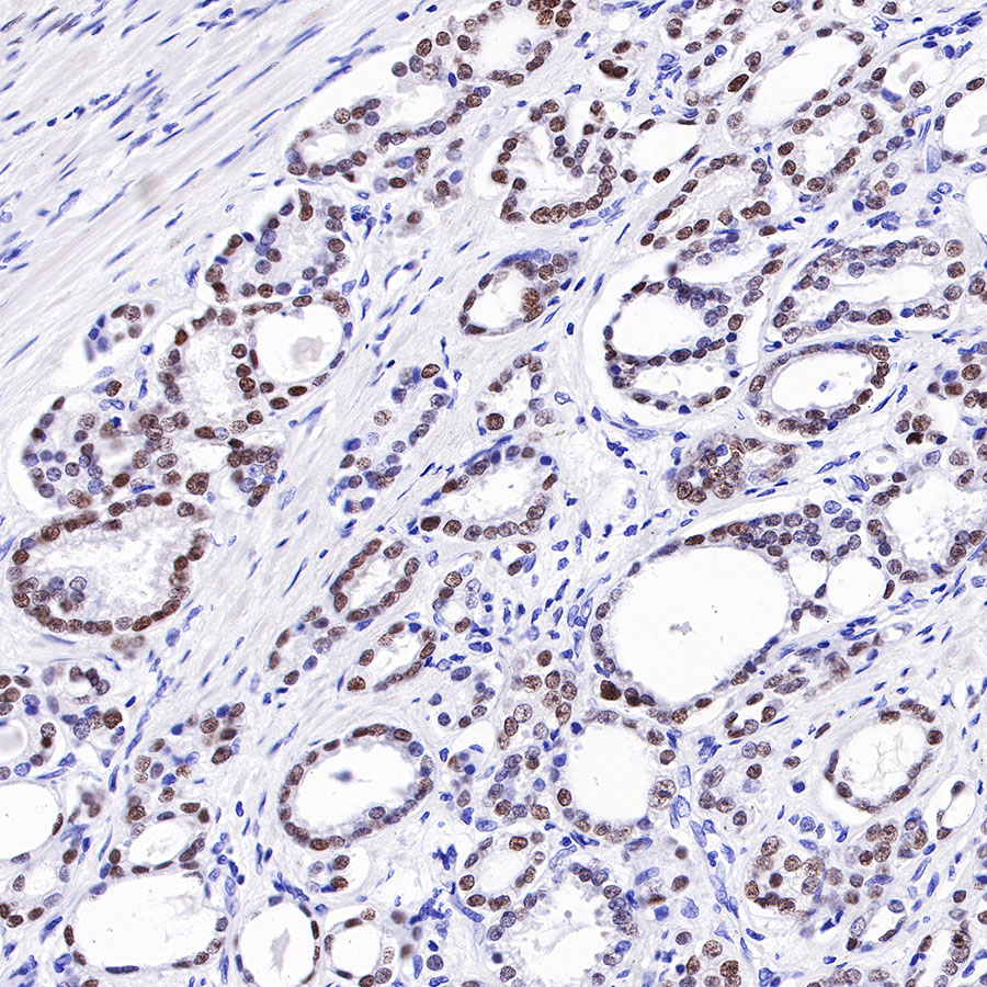 Rabbit anti-Androgen Receptor Recombinant Monoclonal Antibody(R157)