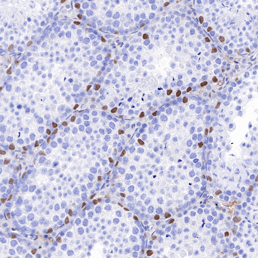 Rabbit anti-SOX9 Recombinant Monoclonal Antibody(019-29)