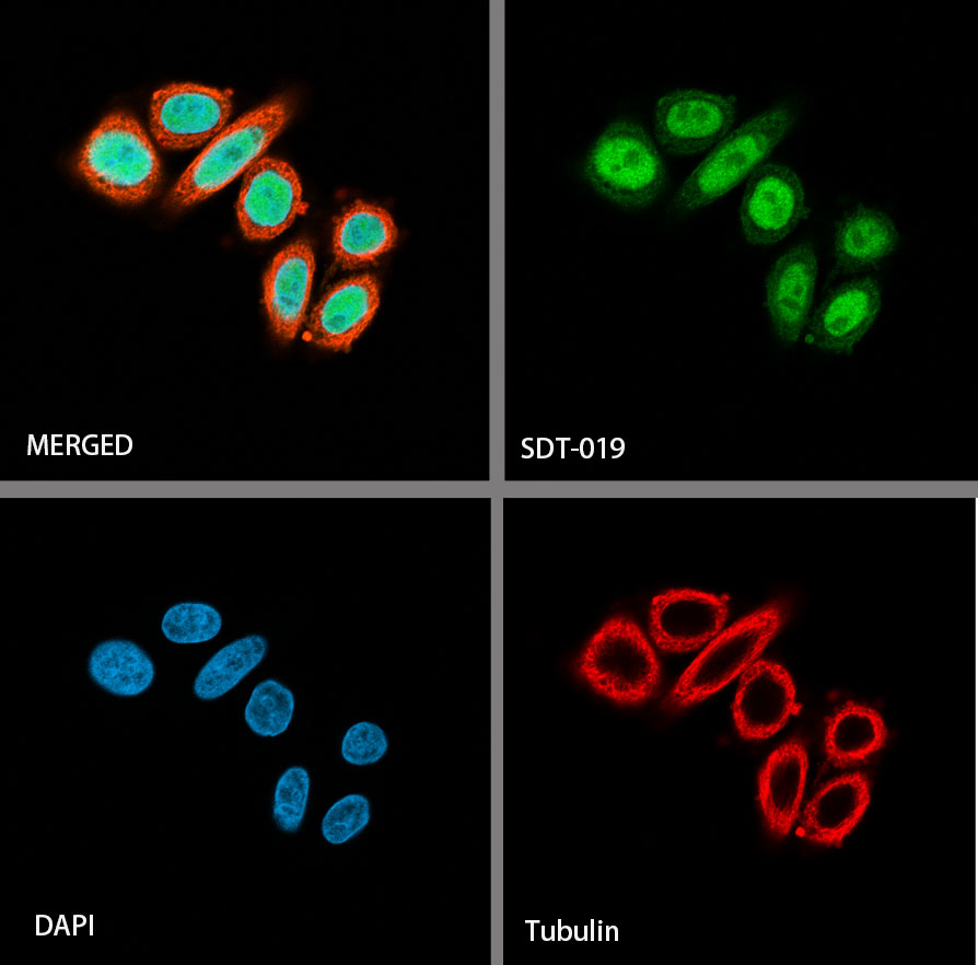 Rabbit anti-SOX9 Recombinant Monoclonal Antibody(019-29)