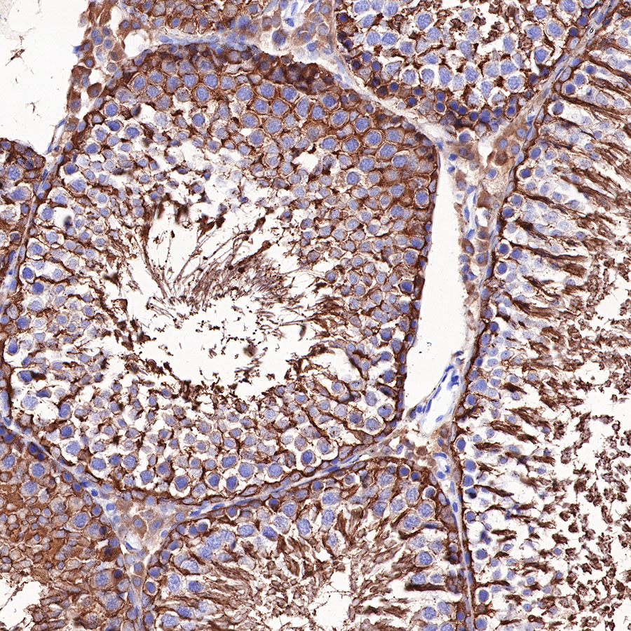 Rabbit anti-β III Tubulin Recombinant Monoclonal Antibody(251-28)