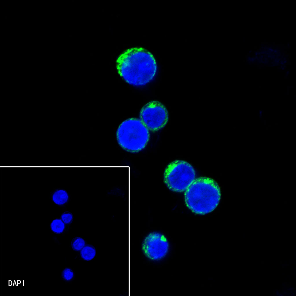 Rabbit anti-λ Light Chain Recombinant Monoclonal Antibody(326-22)