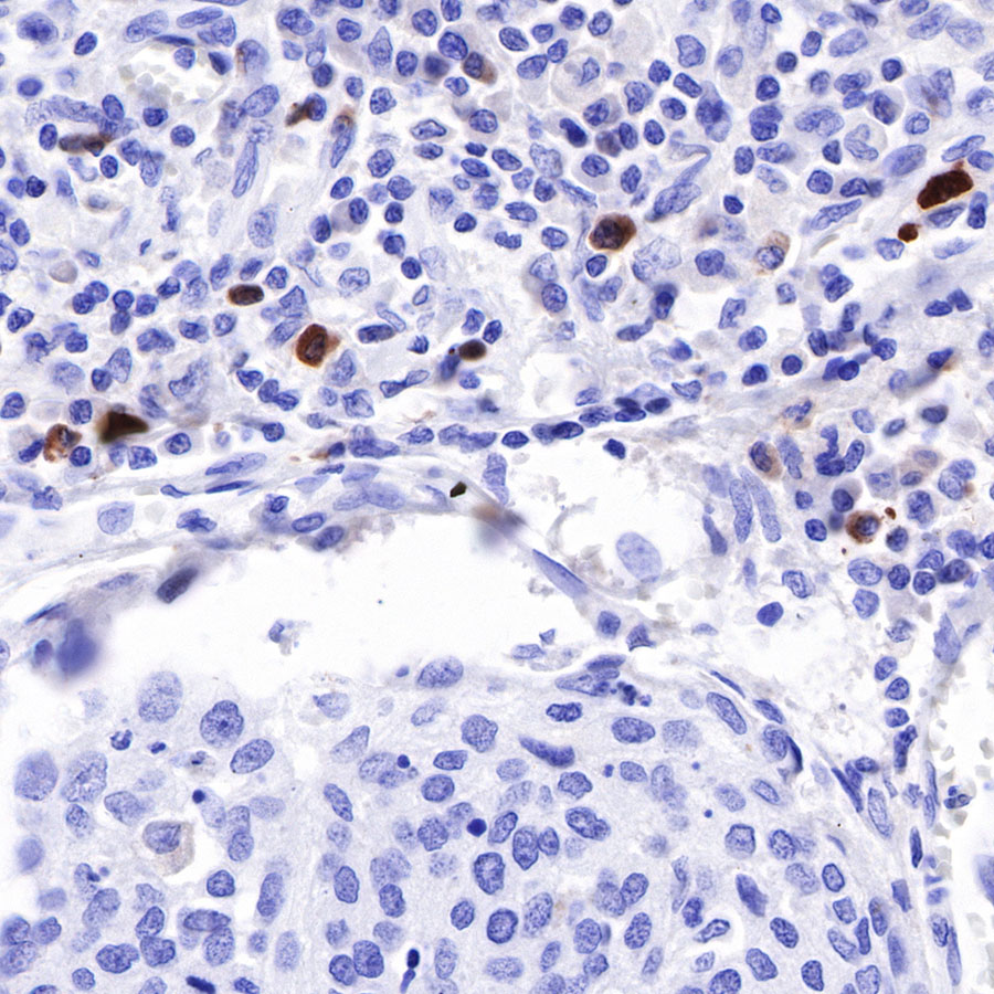 Rabbit anti-λ Light Chain Recombinant Monoclonal Antibody(326-22)