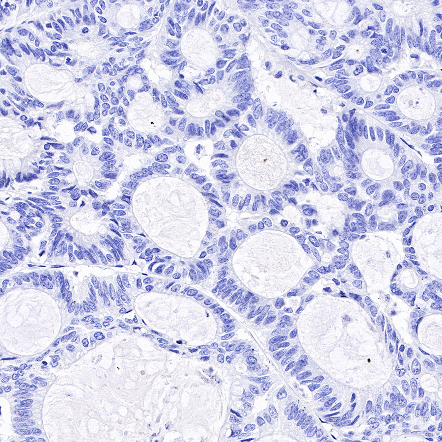 Rabbit anti-Androgen Receptor Recombinant Monoclonal Antibody(R157)
