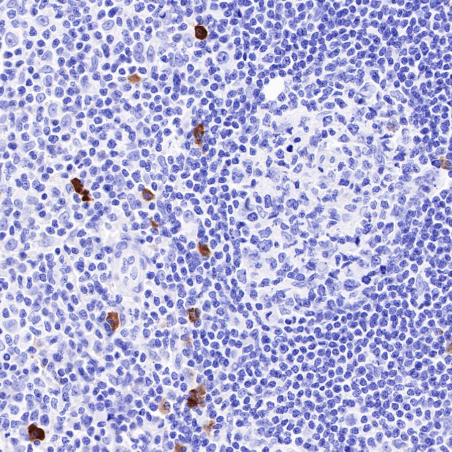 Rabbit anti-λ Light Chain Recombinant Monoclonal Antibody(326-22)