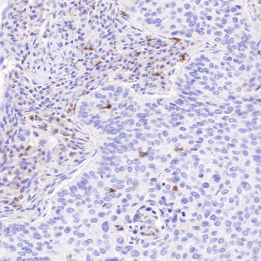 Rabbit anti-CD103 Recombinant Monoclonal Antibody(R134)