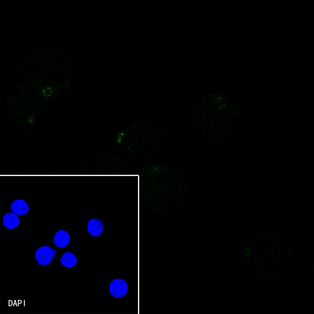 Rabbit anti-CXCR5 Recombinant Monoclonal Antibody(351-24)