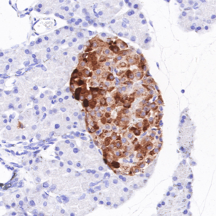 Rabbit anti-Chromogranin A Recombinant Monoclonal Antibody(074-57)