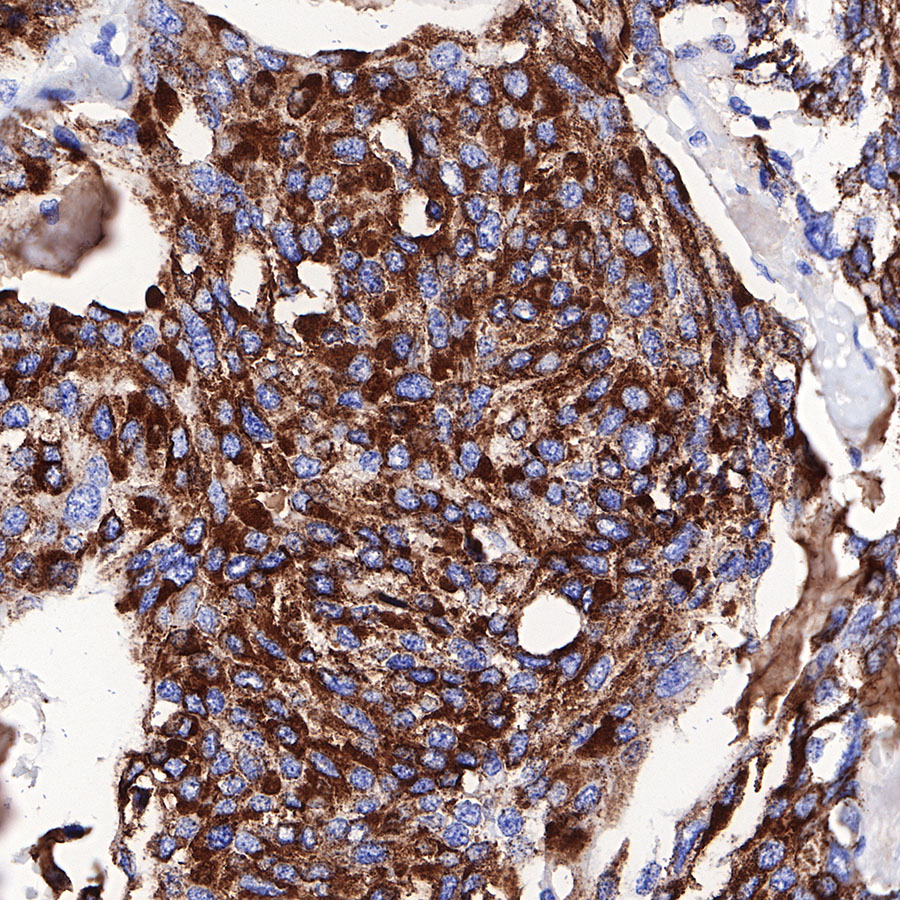Rabbit anti-Chromogranin A Recombinant Monoclonal Antibody(074-57)