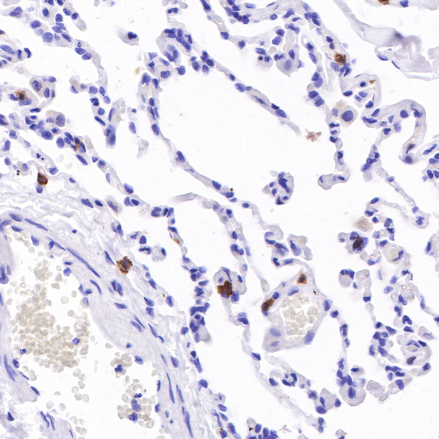 Rabbit anti-CD103 Recombinant Monoclonal Antibody(R134)