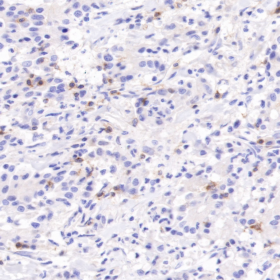 Rabbit anti-CD103 Recombinant Monoclonal Antibody(R134)
