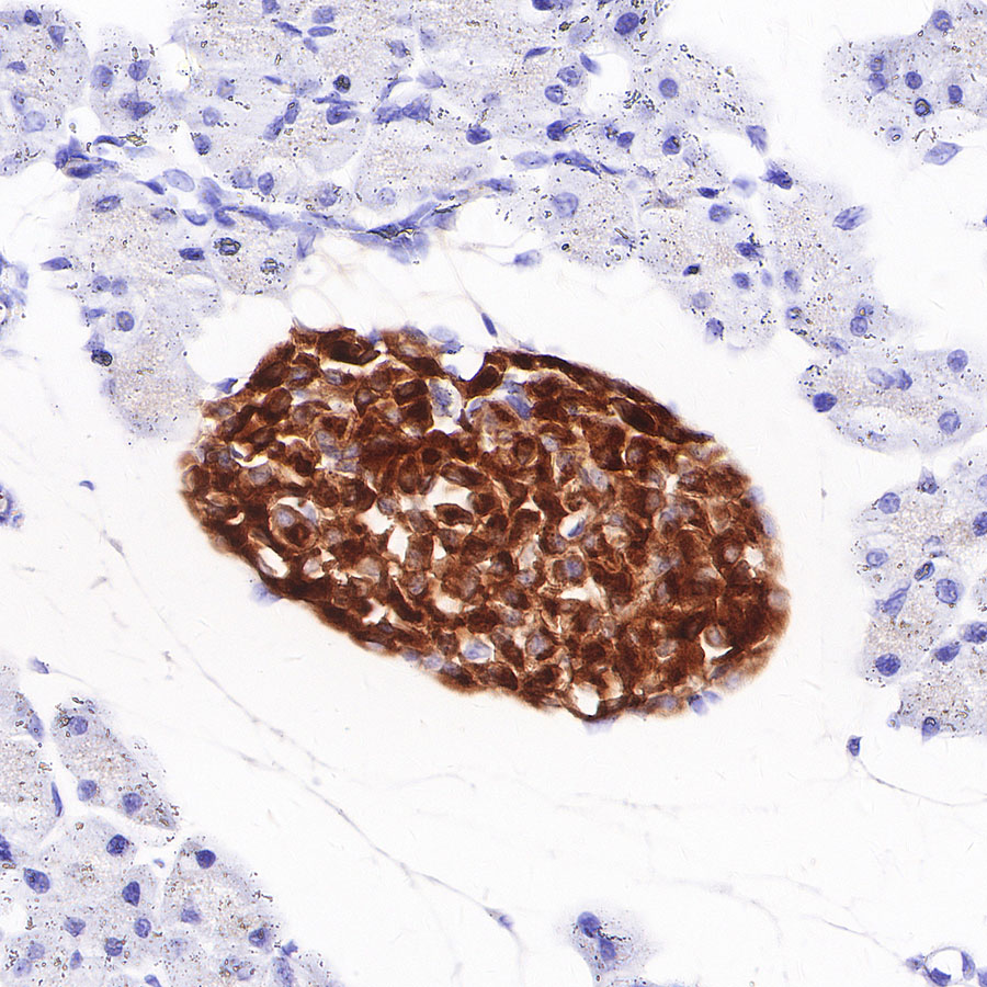 Rabbit anti-Chromogranin A Recombinant Monoclonal Antibody(074-57)