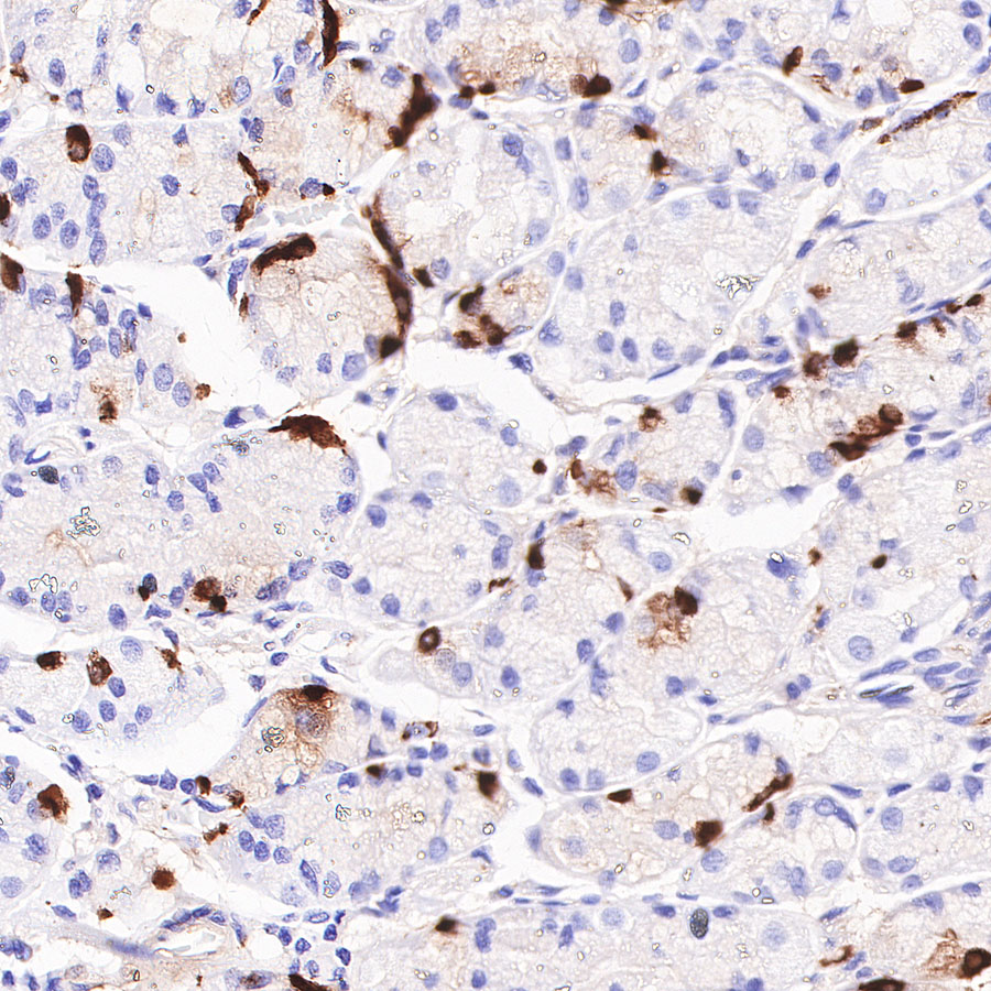 Rabbit anti-Chromogranin A Recombinant Monoclonal Antibody(074-57)