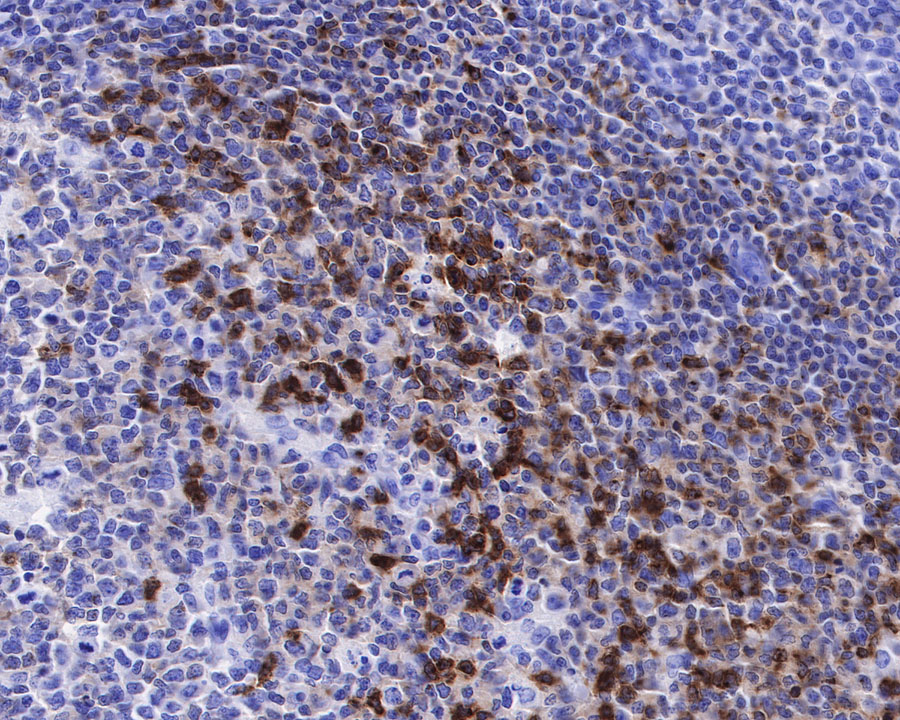 Rabbit anti-CXCR5 Recombinant Monoclonal Antibody(351-24)