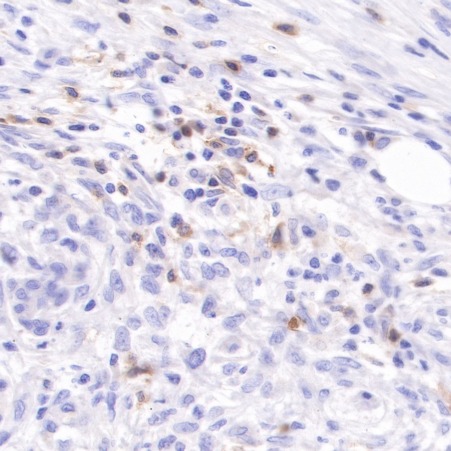 Rabbit anti-CD103 Recombinant Monoclonal Antibody(R134)