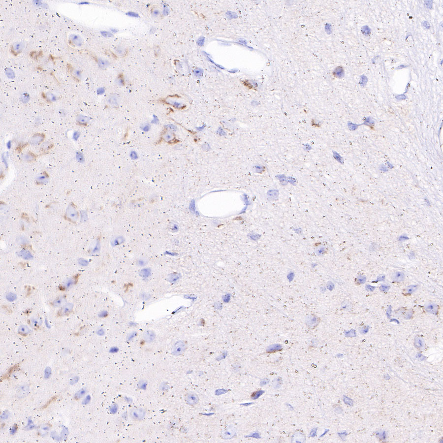 Rabbit anti-Chromogranin A Recombinant Monoclonal Antibody(074-57)
