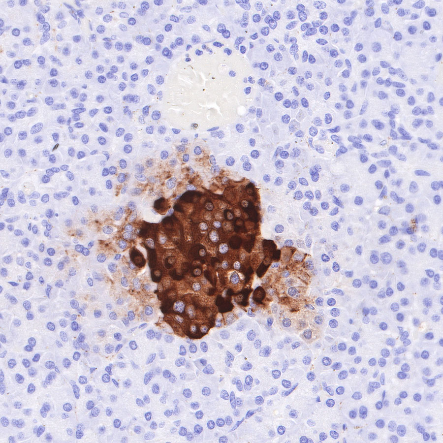 Rabbit anti-Chromogranin A Recombinant Monoclonal Antibody(074-57)