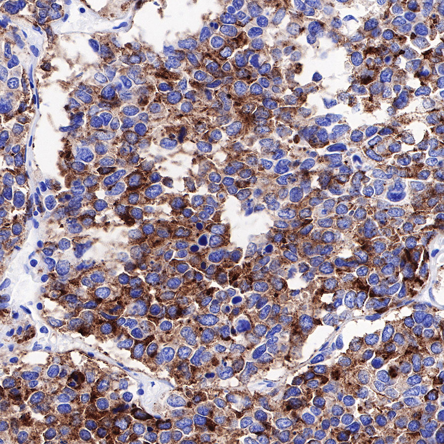 Rabbit anti-Chromogranin A Recombinant Monoclonal Antibody(074-57)