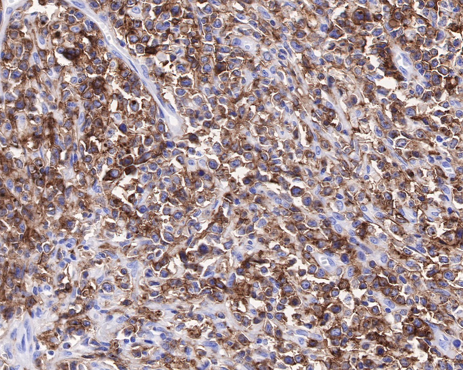 Rabbit anti-CXCR5 Recombinant Monoclonal Antibody(351-24)