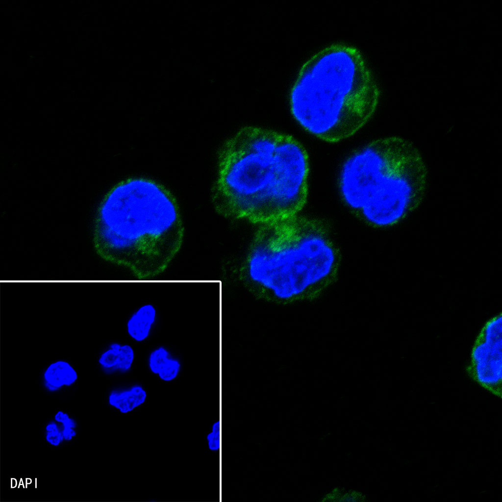 Rabbit anti-CXCR5 Recombinant Monoclonal Antibody(351-24)