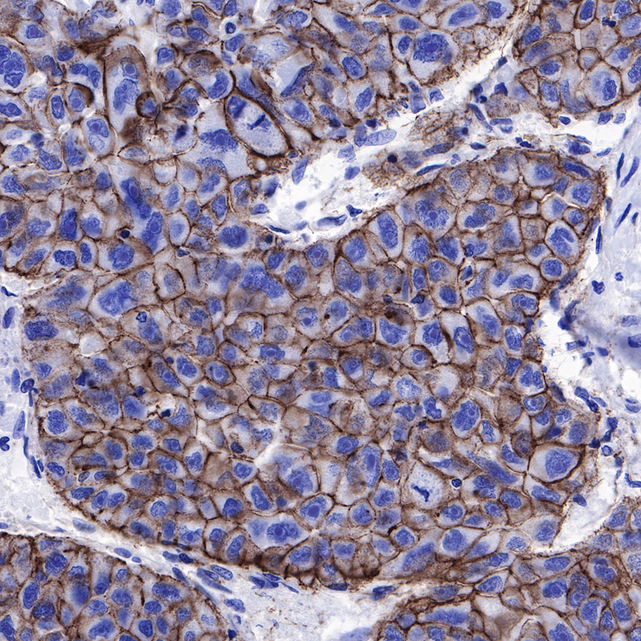 Rabbit anti-β-Catenin Recombinant Monoclonal Antibody(336-23)