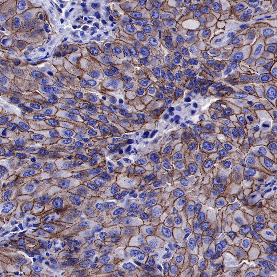 Rabbit anti-β-Catenin Recombinant Monoclonal Antibody(336-23)